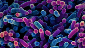 Pseudomonas aeruginosa infection